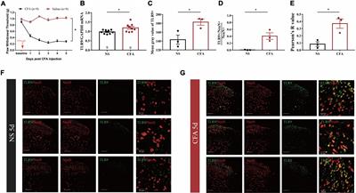 Neuronal toll like receptor 9 contributes to complete Freund’s adjuvant-induced inflammatory pain in mice